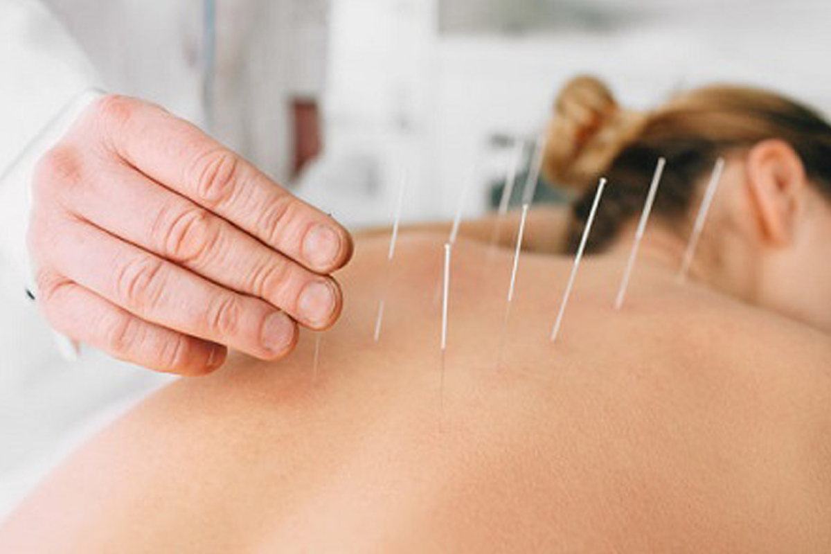 https://naturomedical.com/wp-content/uploads/2020/09/Acupuncture-Procedures-updated.png
